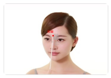 Yintang Point.jpg Yintang Point.jpg